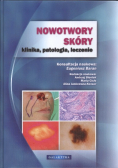 Nowotwory skóry klinika patologia leczenie