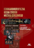Echokardiograficzna ocena chorób mięśnia sercowego