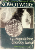 Nowotwory i guzopodobne choroby kości