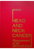 Head and neck cancer