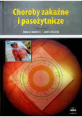 Choroby zakaźne i pasożytnicze