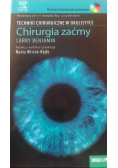 Chirurgia zaćmy