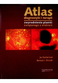 Atlas diagnostyki i terapii zwyrodnienia plamki związanego z wiekiem