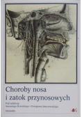 Choroby nosa i zatok przynosowych