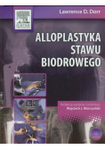 Alloplastyka stawu biodrowego z płytą DVD