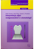Interpretacja zdjęć rentgenowskich w stomatologii