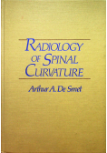 Radiology of Spinal Curvature