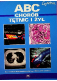 ABC chorób tętnic i żył