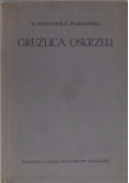 Gruźlica oskrzeli