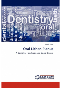 Oral Lichen Planus