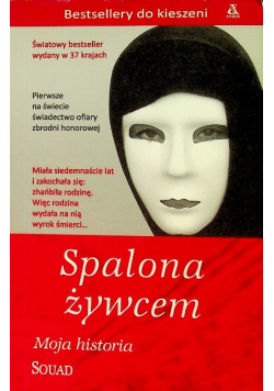 Spalona żywcem moja historia