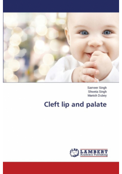 Cleft lip and palate