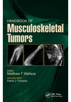Handbook of Musculoskeletal Tumors