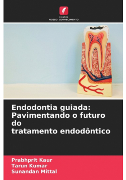 Endodontia guiada