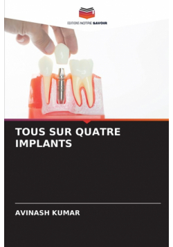 Tous Sur Quatre Implants