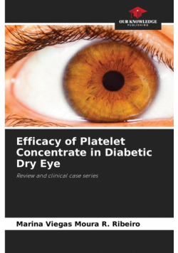 Efficacy of Platelet Concentrate in Diabetic Dry Eye