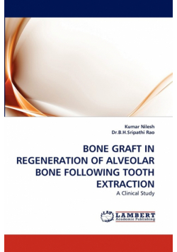 Bone Graft in Regeneration of Alveolar Bone Following Tooth Extraction