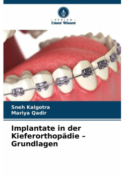 Implantate in der Kieferorthopädie - Grundlagen