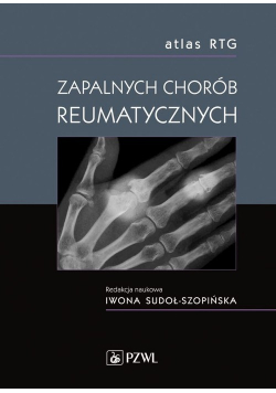 Atlas RTG zapalnych chorób reumatycznych