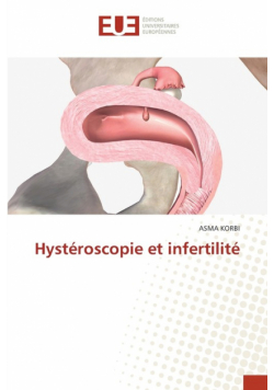 Hystéroscopie et infertilité