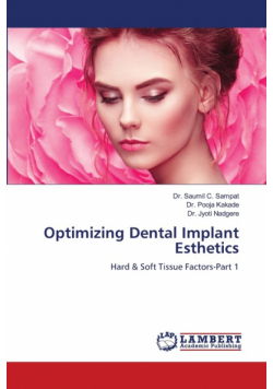 Optimizing Dental Implant Esthetics