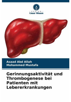 Gerinnungsaktivität und Thrombogenese bei Patienten mit Lebererkrankungen