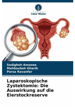 Laparoskopische Zystektomie