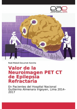 Valor de la Neuroimagen PET CT de Epilepsia Refractaria