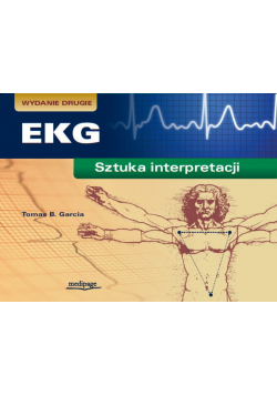 EKG sztuka interpretacji