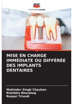 Mise En Charge Immédiate Ou Différée Des Implants Dentaires