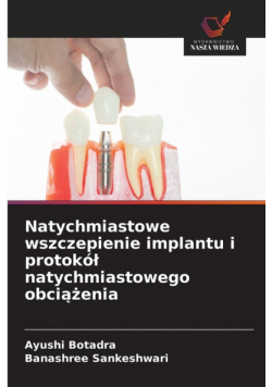 Natychmiastowe wszczepienie implantu i protokół natychmiastowego obciążenia