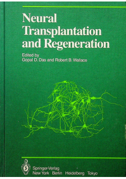Neural Transplantation
