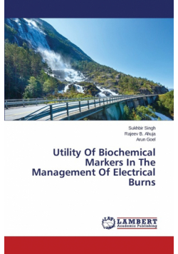 Utility Of Biochemical Markers In The Management Of Electrical Burns