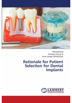 Rationale for Patient Selection for Dental Implants