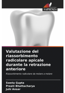 Valutazione del riassorbimento radicolare apicale durante la retrazione anteriore