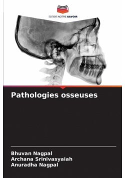 Pathologies osseuses