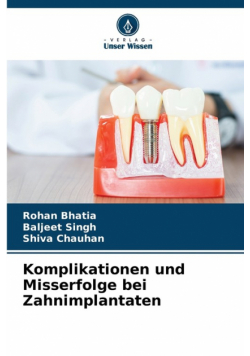 Komplikationen und Misserfolge bei Zahnimplantaten