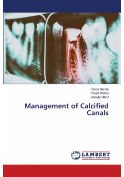 Management of Calcified Canals