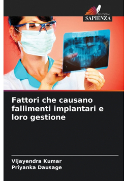 Fattori che causano fallimenti implantari e loro gestione