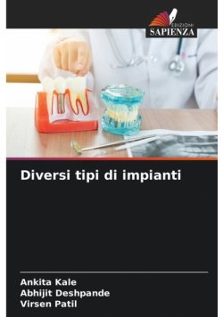 Diversi tipi di impianti
