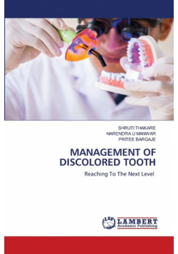 Management Of Discolored Tooth