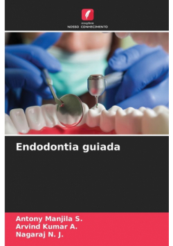 Endodontia guiada