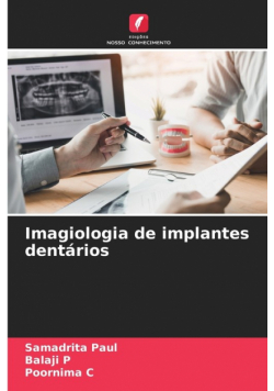 Imagiologia de implantes dentários