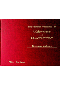 A colour Atlas of left hemicolectomy