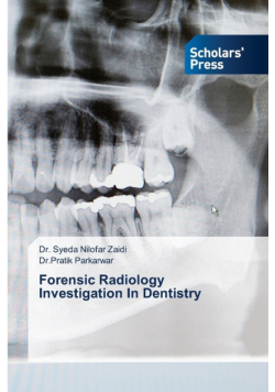 Forensic Radiology Investigation In Dentistry