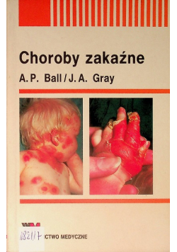 Choroby zakaźne