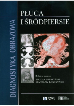 Diagnostyka obrazowa. Płuca i śródpiersie