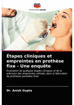 Étapes cliniques et empreintes en prothèse fixe - Une enquête