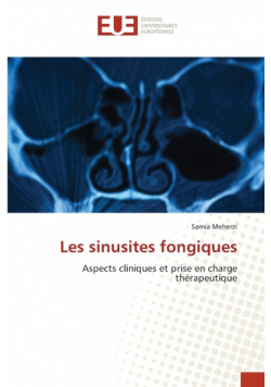 Les sinusites fongiques