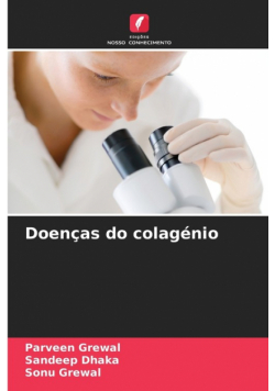 Doenças do colagénio